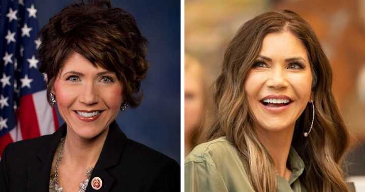 Kristi Noem Before-And-After Pictures Through The Years