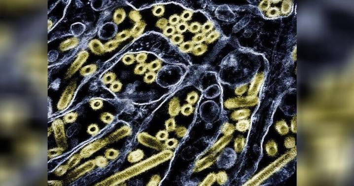 1st US human bird flu case in 9 months confirmed with strain only seen in animals before