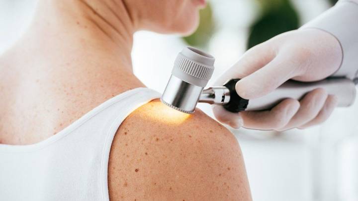 Campaña de prevención del cáncer de piel en la Calle Recreativa