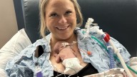 'Micro-preemie' born at less than one pound thrives after state