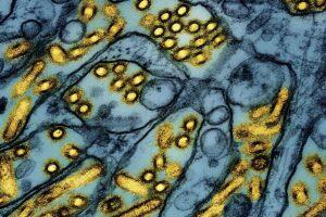 Washington resident dies of complications from bird flu strain never before reported in humans