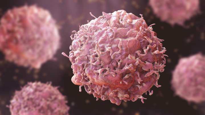 J&K reports 6000 new cancer cases every year