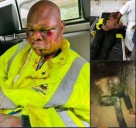 Mob Attacks Police Officers, Damages Vehicle During Arrest in Machinga