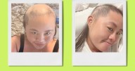 18 Million People Watched My Hair Grow Back After I Went Bald