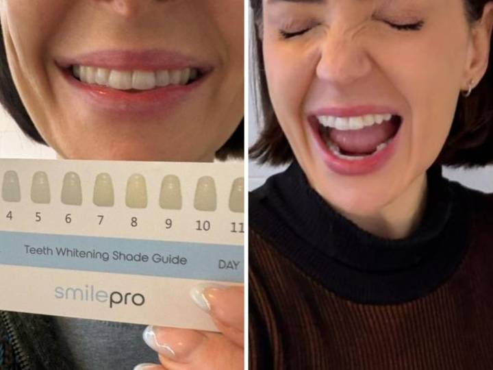 ‘Teeth reset’: 50pc off whitening kit 3.4k love
