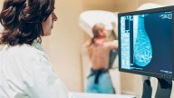 Missing the first mammogram linked to increased risk of breast cancer death, new study suggests