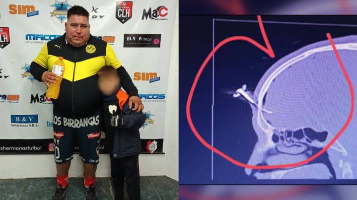 Delegado de fútbol infantil y con violentos antecedentes: quién es el protagonista del brutal ataque con una llave tras un partido juvenil
