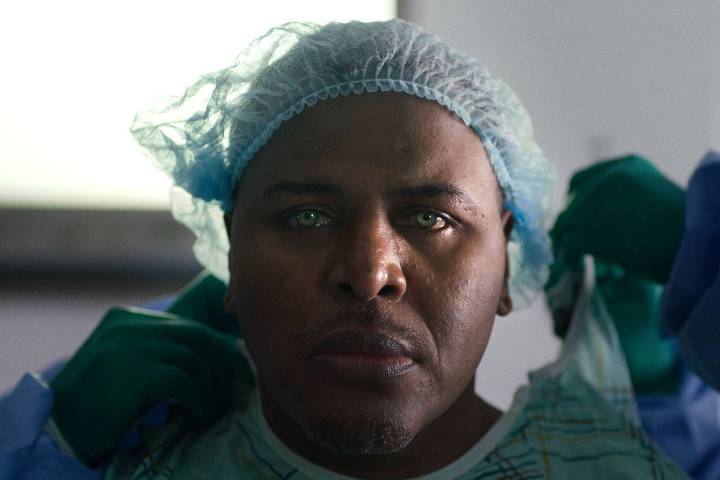 A Biracial Man Faces 'Scary' Toll After Changing Eye Color Through Risky Surgery