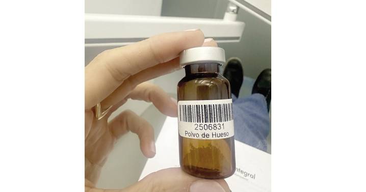 Polvo de huesos