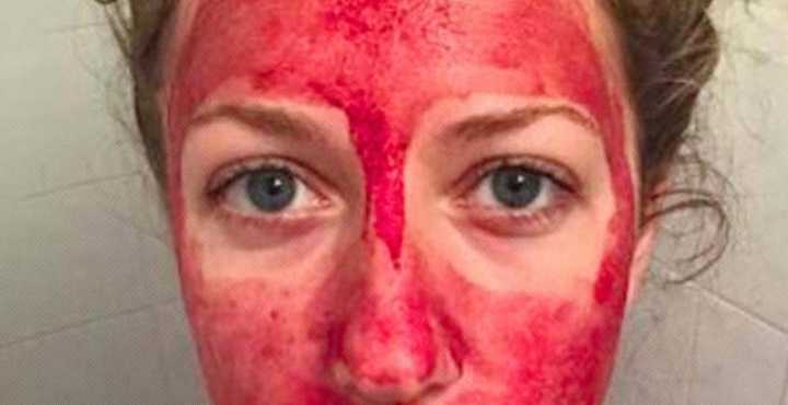 Influencers Are Pushing Period-Blood Skincare. Does It Actually Work?