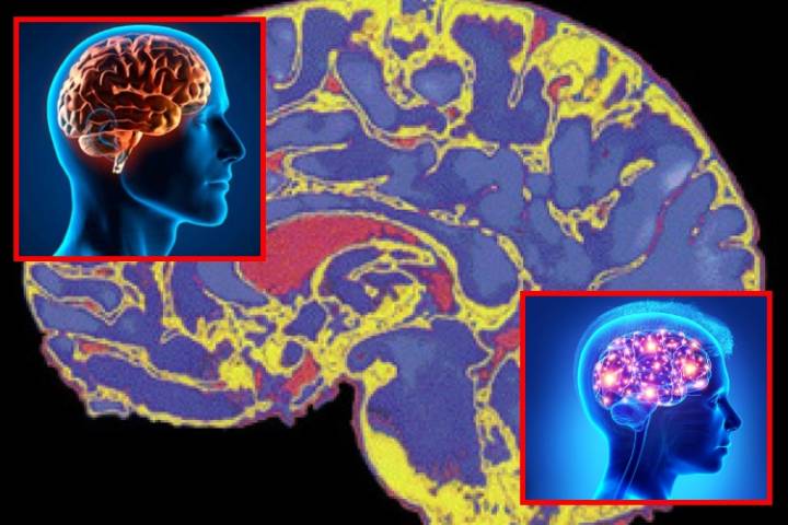 El cerebro sigue en modo adolescente hasta los 30 años, según estudio