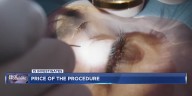 Price of the Procedure: Madison LASIK patients warn of complications from elective surgery