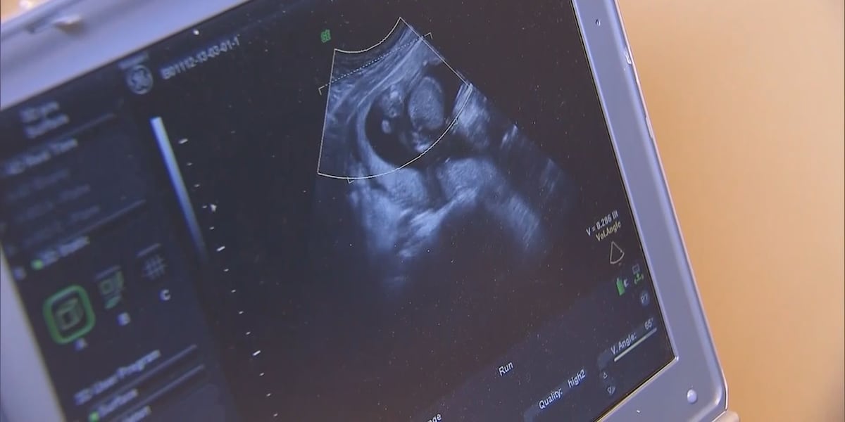 S.C. lawmakers vote against most restrictive abortion bill in the US