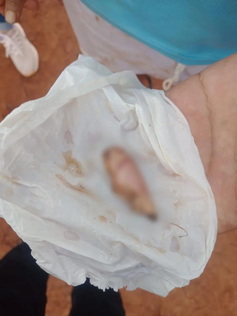 Posadas: una menor atacó con un cuchillo a una mujer y le arrancó parte de la oreja