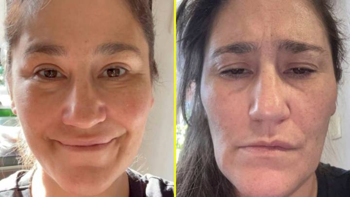 Pensó que "iba a morir del dolor": Estos son síntomas de la neuralgia del trigémino, la afección que aqueja a Belén Mora