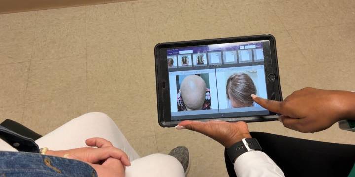 New pill could be the future of hair