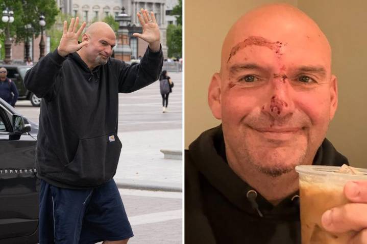 John Fetterman shares photo of bloodied face as he's released from hospital after fall