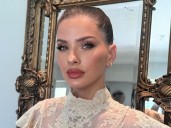 La China Suárez sufrió un insólito accidente: se quemó una parte del cuerpo y causó preocupación