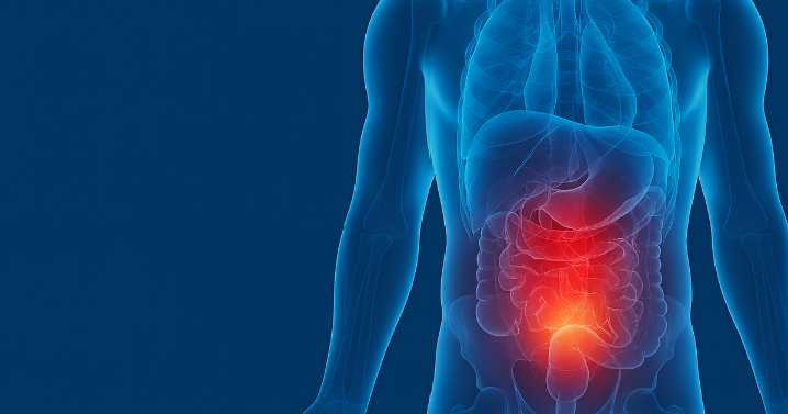 ¿Es posible prevenir el cáncer de próstata? ¿Cuáles son los factores de riesgo?