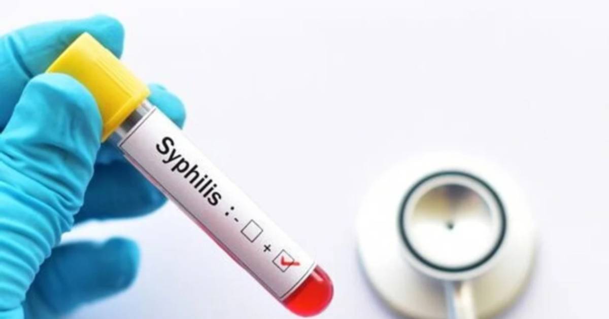 Aumentaron un 20,5% los casos de sífilis en Argentina