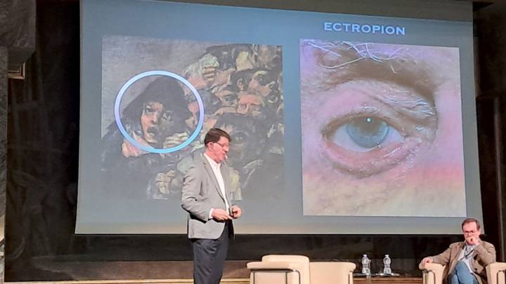 Un reconocido médico maxilofacial desvela las malformaciones de las caras de Goya: "Carlos III sufría retrognatismo mandibular"