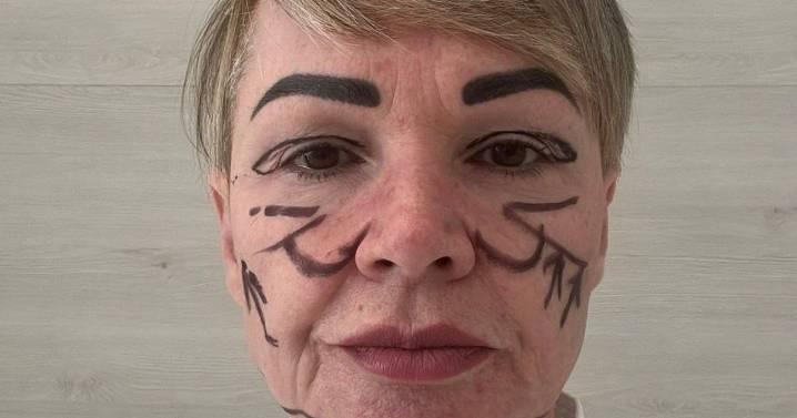 'I flew to Lithuania for £8,000 facelift - now I've lost hearing and have lopsided face'