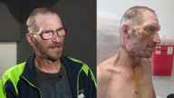 WA DoorDash driver recounts after vicious attack