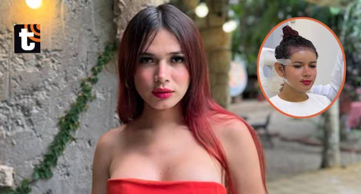 La ‘Uchulú’ se somete a trasplante capilar y sorprende a sus seguidores: “Con la frente en alto” La creadora de contenido sorprendió en redes al revelar su renovada imagen tras someterse a un trasplan