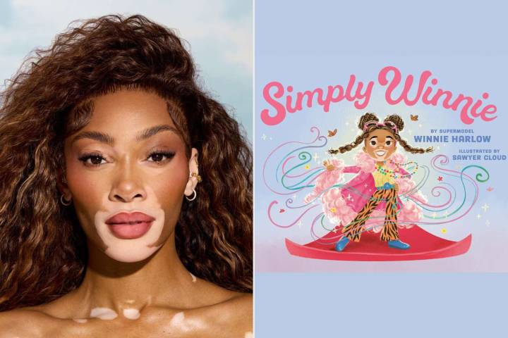 Supermodel Winnie Harlow Announces Simply Winnie, Inspired by Her Own Childhood