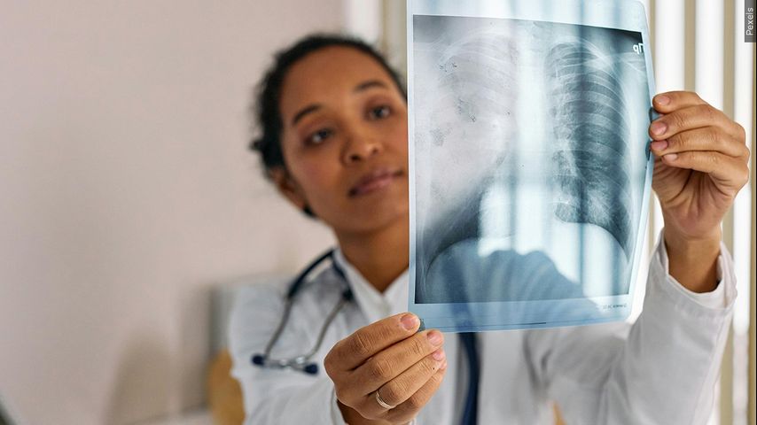 Wednesday's Health Report: How lung cancer screenings can save lives