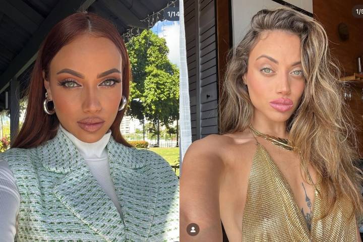 Catherine Castro, hospitalizada de emergencia: ¿qué le pasó a la actriz de Televisa?