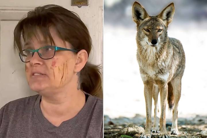 Woman Attacked by a Coyote Outside Her Home: ‘You Can’t Get That Out of Your Head’