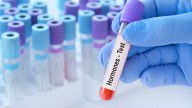 Are your hormones imbalanced? How to know if you need testing