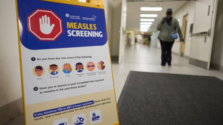 Canada loses measles elimination status — as does the entire Americas region