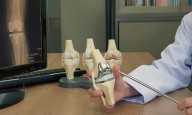 NPPA Continues Price Cap on Orthopedic Knee Replacement Implants for Another Year Till November 15,...