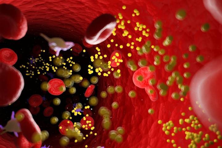 Sequential Screening for Heterozygous Familial Hypercholesterolemia Not Cost