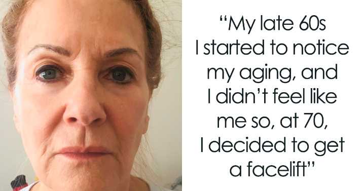 Woman Shares Her Aging Progress And How She Looks After Getting A Facelift At 70 Years Old