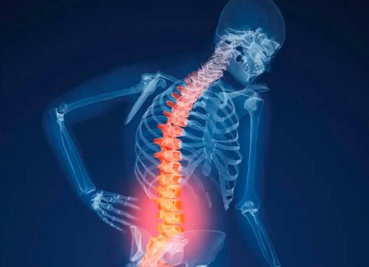 UAdeC realizará Jornada de Densitometrías Óseas Gratuitas para la detección de osteoporosis