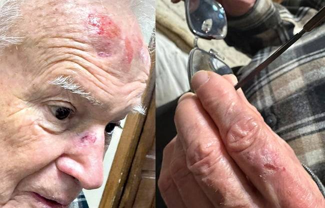 Sufre Obispo Vera lesiones tras caída; permanece en observación