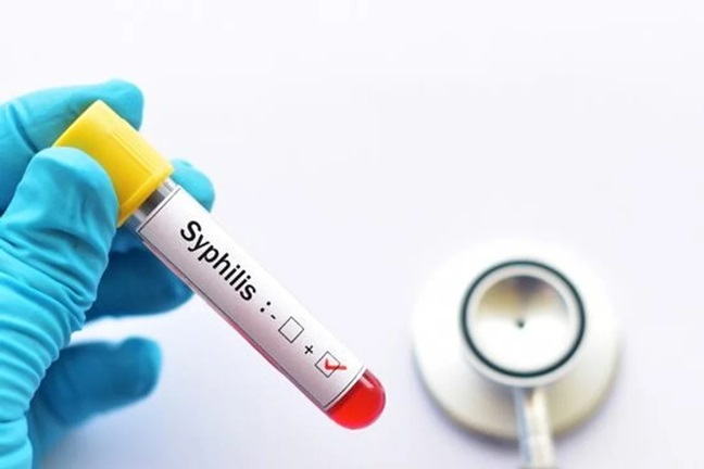 Alerta sífilis: los casos se incrementaron un 20,5% en Argentina