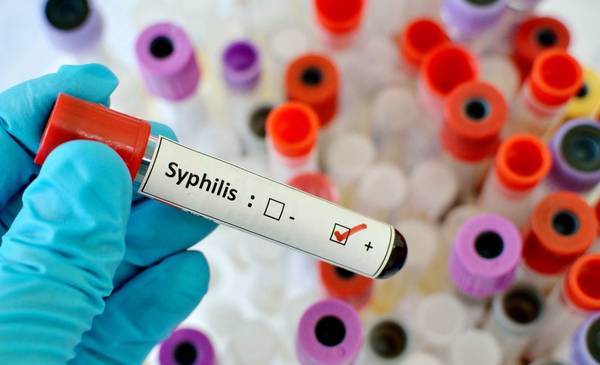 Sífilis en ascenso: alerta por el aumento de casos y las edades afectadas