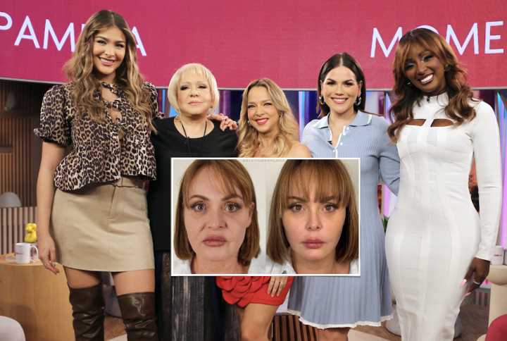 Rostro rejuvenecido de Gaby Spanic causa sensación
