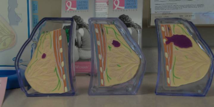 Not all breast cancers start with a lump. Be on the lookout for these rare symptoms