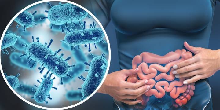 Cuál es la diferencia entre el SIBO y el síndrome del intestino irritable (SII)