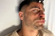 Imágenes sensibles: le clavó una llave en la cabeza a un exfutbolista por una pelea en un torneo de fútbol