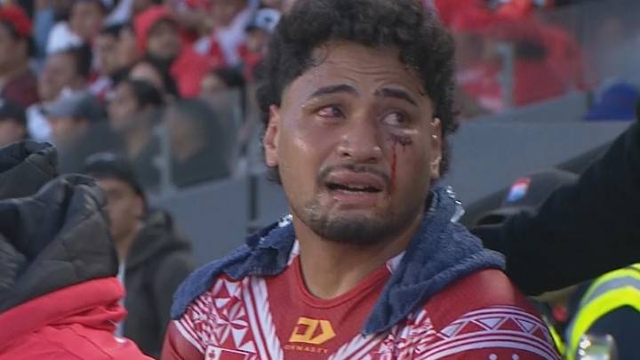 'Should never have happened': Katoa incident sparks call for change