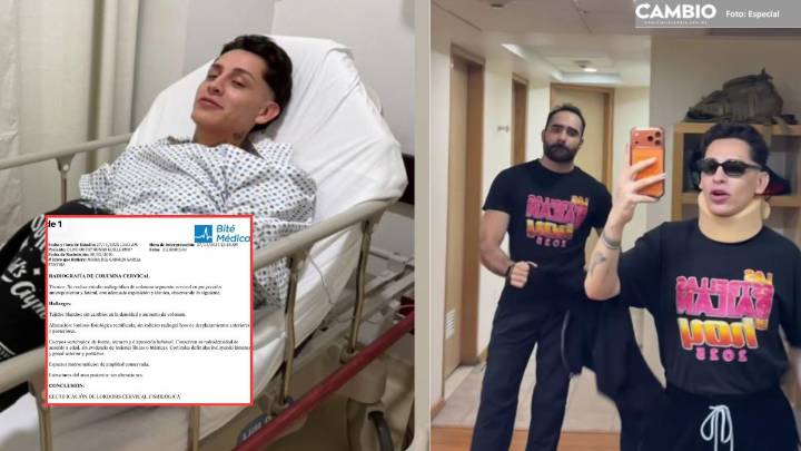 Hospitalizan a Kunno tras accidente automovilístico; ¿Todavía participará en Las Estrellas Bailan en Hoy?