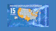 No cases of infant botulism in New Mexico amid outbreak, according to health officials
