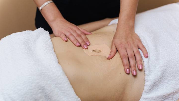 ISP emite alerta por venta de parches para "bajar de peso" sin registro sanitario: ¿Cuáles son sus riesgos?