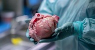 Could Pig Kidneys End the Transplant Shortage? First U.S. Trial Begins